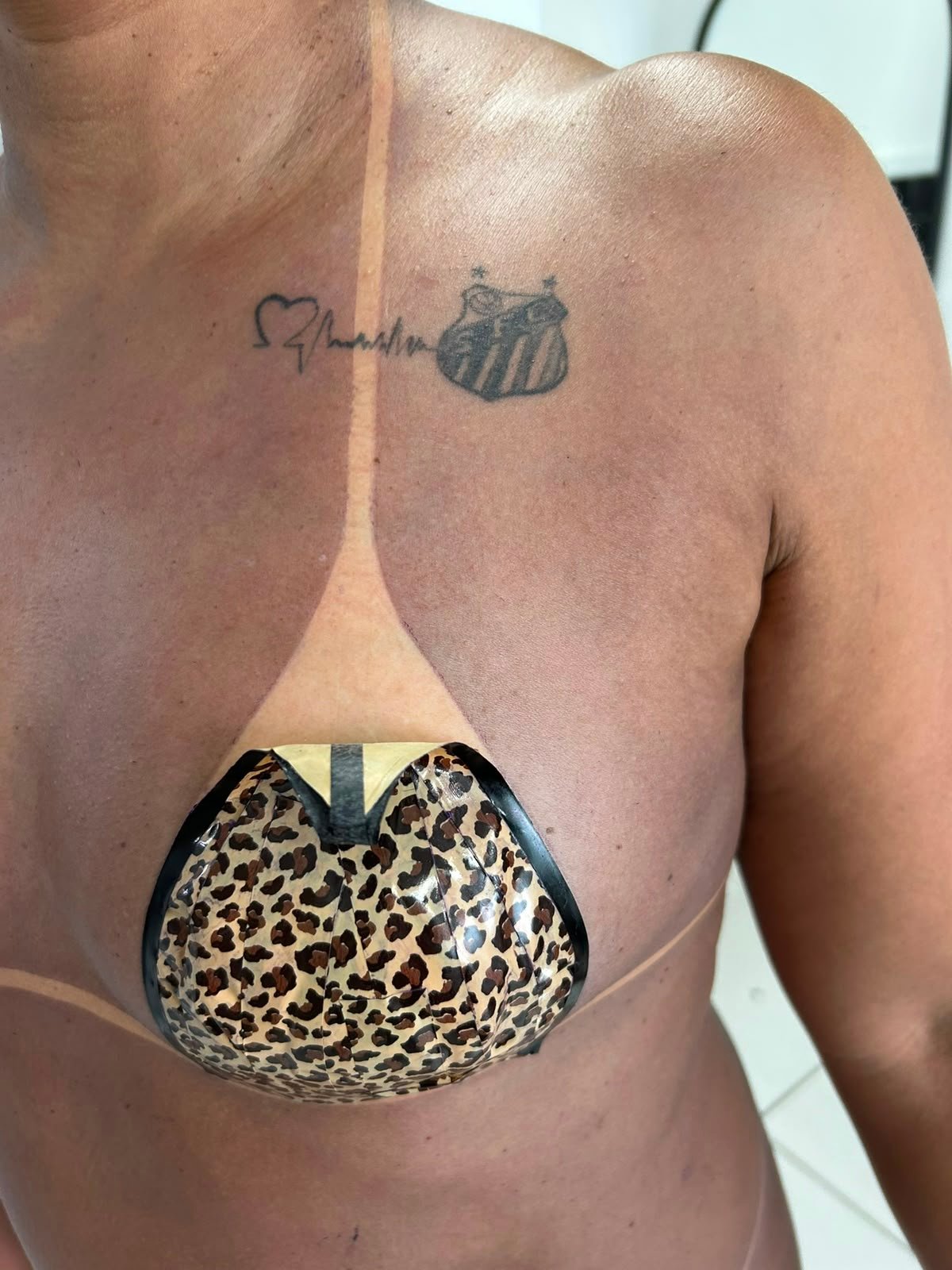 Resultado de bronzeamento corpo inteiro
